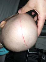 Skalpierungsversuch!